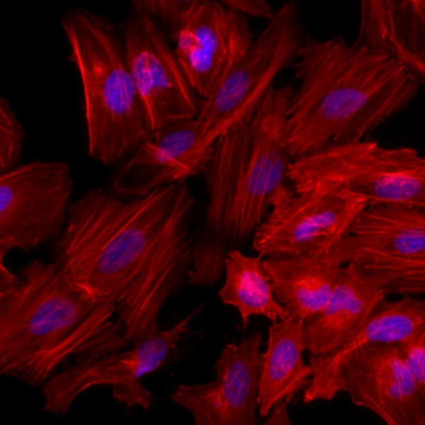 TRITC Phalloidin標記鬼筆環(huán)肽  Actin-Tracker Red-Rhodamine (微絲紅色熒光探針)